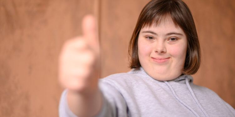 exposição Down uma Chance